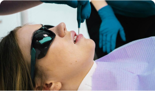 Відбілювання